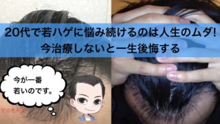 生まれつきのm字ハゲはハゲではない 進行したならすぐにでも対処を 若ハゲのモテ道